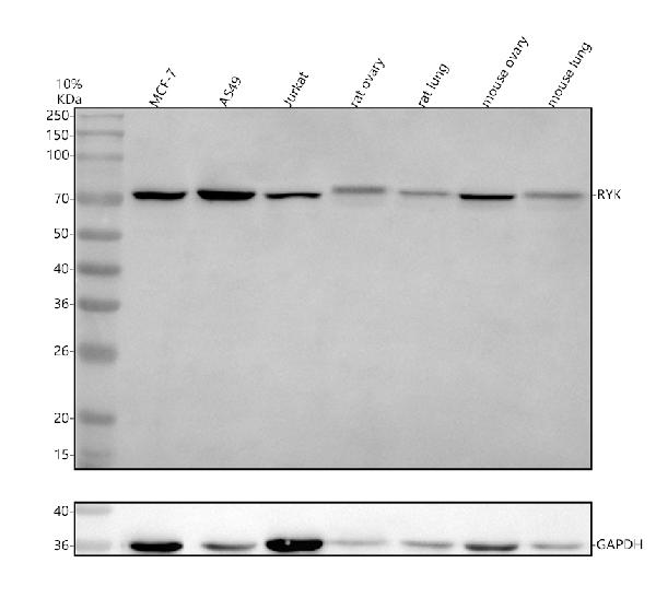Anti-RYK Antibody Picoband®